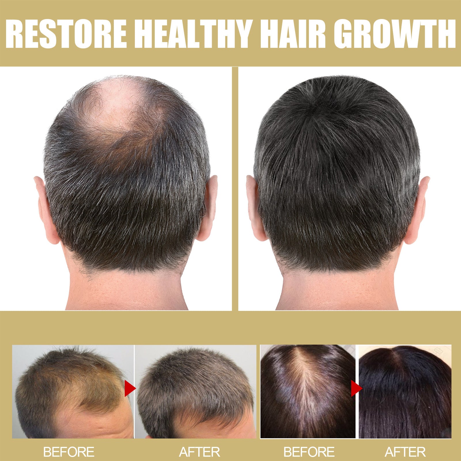 Houkea Dense Toupee Hair Repair Manic